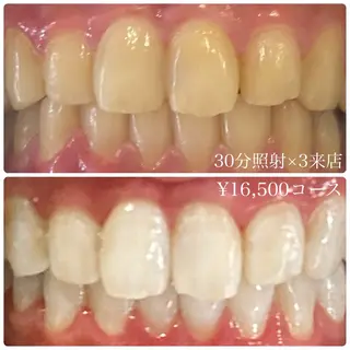 メンズ ホワイトニングルーム　川崎店所属・ホワイトニング ルーム　川崎店のその他イメージ