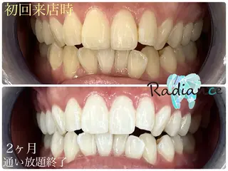 札幌ホワイトニング ラディアンス札幌駅店のその他イメージ