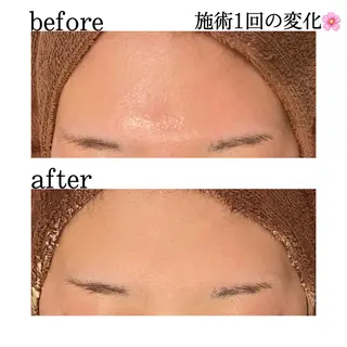 触れたくなる モテ肌へ...❤︎のエステ・リラクイメージ