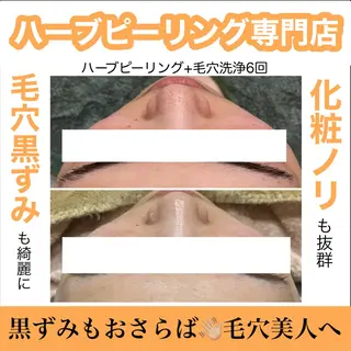 ハーブピーリング専門 muro.のエステ・リラクイメージ