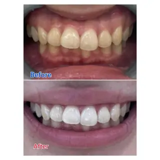 MBEAUTYSALON 千葉店・京成大久保所属・Melty 輝のその他イメージ