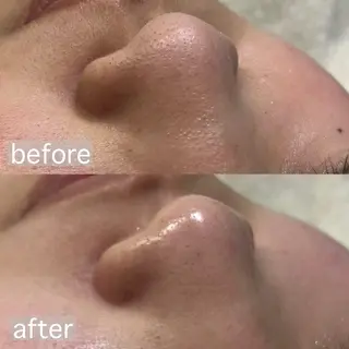 アイブロウ&フェイシャルサロンa‘lm所属・WAX脱毛/肌質改善 眉毛とお肌のサロンのエステ・リラクイメージ