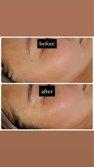 Luce所属・Luce Shokoのエステ・リラクイメージ