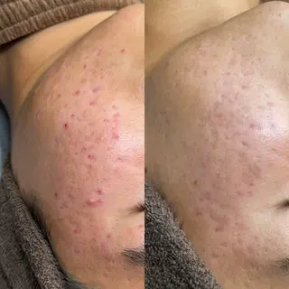 エステサロンTug高知駅前店所属・Tug 高知駅前店/ NANAMIのその他イメージ