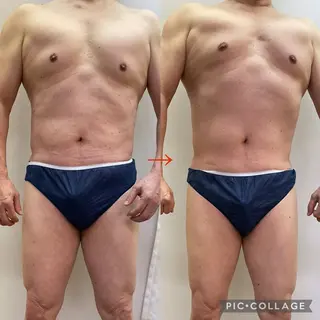 メンズ トータルビューティーサロン LilyRose所属・エステサロン LilyRoseのエステ・リラクイメージ