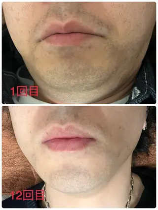 メンズ Mens Salon SOLEのエステ・リラクイメージ