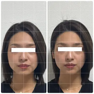 くつろぎ小顔サロン Lu mellow所属・片山けいこ| 美人顔創りの専門家のエステ・リラクイメージ