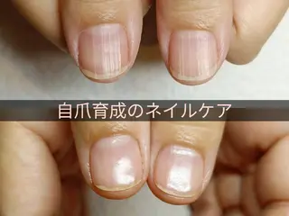 ネイル 深爪矯正/爪育成ケア manie nailのネイルデザイン