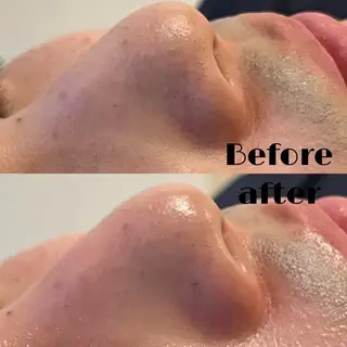 LUMIERE(ルミエル)福岡春吉店所属・LUMIERE 福岡のエステ・リラクイメージ