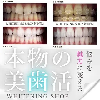 メンズ ホワイトニング ショップ新小岩店のその他イメージ