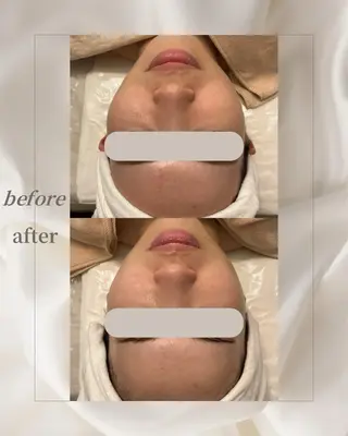 【WAKOBI】beauty salon所属・【WAKOBI】be auty salonのエステ・リラクイメージ