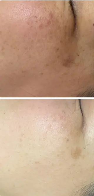 調律エステ /美KISSのその他イメージ