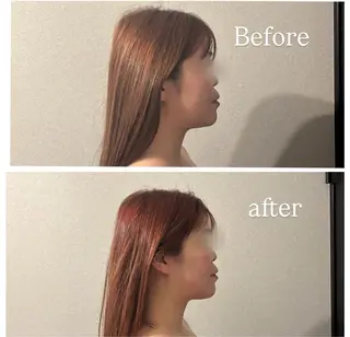 歴14年！劇的 小顔矯正Luanaのエステ・リラクイメージ