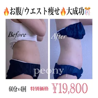 デトックス美容専門サロンｐｅｏｎｙ所属・デトックス美容専門 サロンｐｅｏｎｙのエステ・リラクイメージ