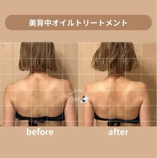 【頭痛、睡眠改善】 salon RUUのエステ・リラクイメージ