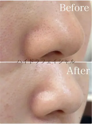 Belle beauty salon所属・Bellebeau tysalonのエステ・リラクイメージ