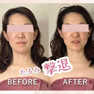 hitohana所属・毛穴/いちご鼻/小顔 /hitohanaのエステ・リラクイメージ