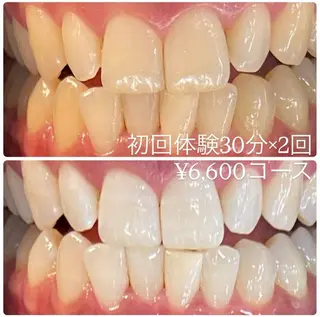 メンズ ホワイトニングルーム　川崎店所属・ホワイトニング ルーム　川崎店のその他イメージ