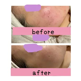 毛穴・リンパ・肌ケア サロン スリールのエステ・リラクイメージ