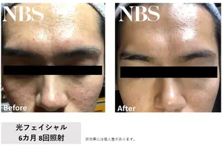 E'clat所属・E'clat Kanaのエステ・リラクイメージ