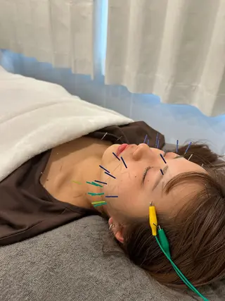 美容鍼＆鍼灸サロン 鍼Glitter.岡山駅前店所属・田中 美奈のエステ・リラクイメージ