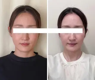 丸顔さんの救世主 高田 くみのエステ・リラクイメージ