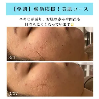 Bellesthe (ベルエステ)のエステ・リラクイメージ