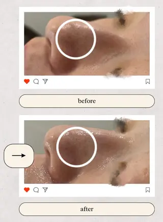 AY'S所属・倉敷/玉島/毛穴洗浄 古川碧のエステ・リラクイメージ