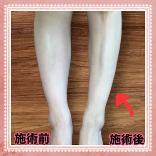 こり解消オイルリンパ ムーンリズムのエステ・リラクイメージ