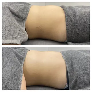 温活未病ケアサロン CoQのエステ・リラクイメージ