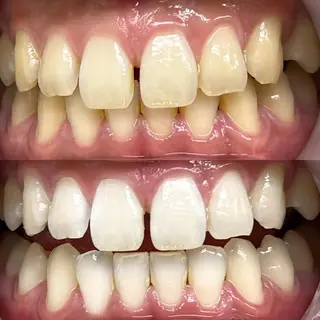 LBSホワイトニング 銀座店💎公式のその他イメージ