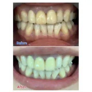 M渋谷店所属・M渋谷 ホワイトニングのエステ・リラクイメージ