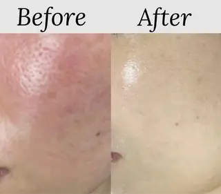 都度払い 肌質改善専門サロンのエステ・リラクイメージ