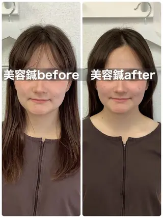 メディカルサロンドオフ所属・ハリサロンドオフ 美容鍼灸×小顔整体のエステ・リラクイメージ