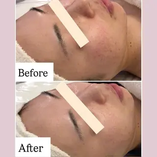 リフトアップ小顔 専門のエステ・リラクイメージ