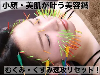 美容鍼灸Solana所属・肌質改善×美容鍼 ゆいのエステ・リラクイメージ