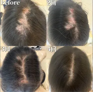 Blooming所属・LOUISE. ／肌質・頭皮のエステ・リラクイメージ