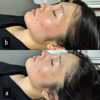 217whitening  room所属・217 ホワイトニングルームのエステ・リラクイメージ