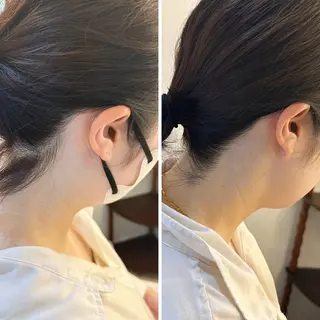 うなじ脱毛/美肌脱毛 LABELのエステ・リラクイメージ