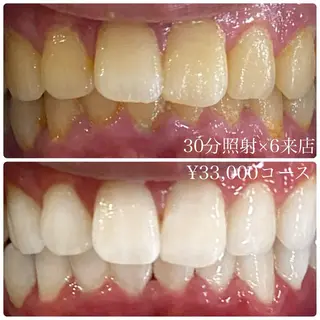 PLATINUM Beauty 横浜店所属・ホワイトニングルーム 横浜店のその他イメージ