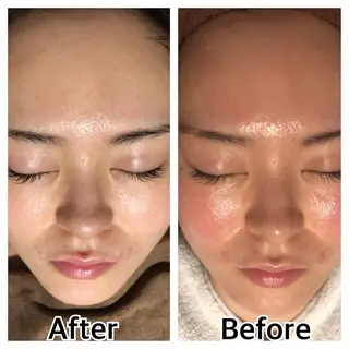 林 陽向のエステ・リラクイメージ