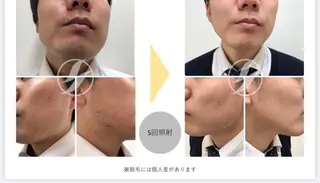 メンズ esperanza エスペランサのエステ・リラクイメージ