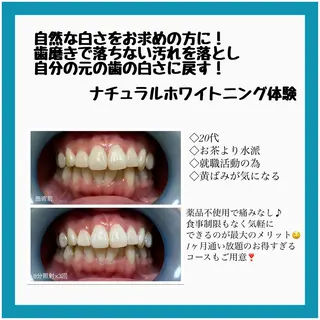 ネイル/耳つぼ /新ホワイトニングのネイルデザイン