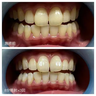 ネイル/耳つぼ /新ホワイトニングのネイルデザイン