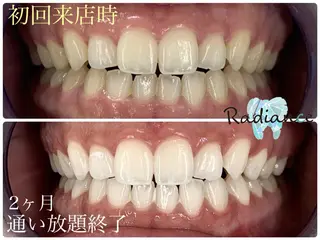 札幌ホワイトニング ラディアンス菊水店のその他イメージ