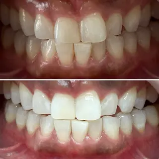 whitening salon yatto.所属・ホワイトニングサロン yatto.のその他イメージ