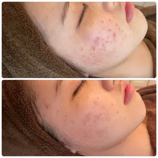 【Resetlab】 Chihiroのエステ・リラクイメージ