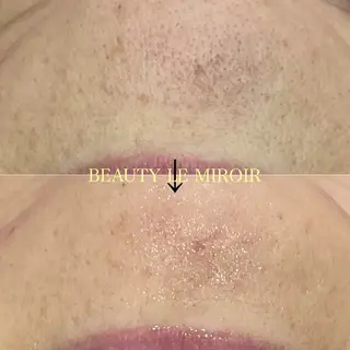 ビューティー ミロワールのエステ・リラクイメージ