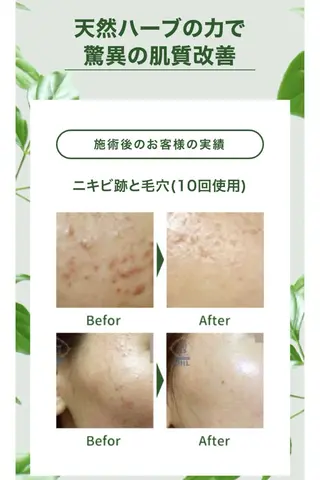 肌質改善 ルポエトワのエステ・リラクイメージ