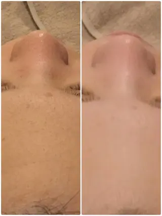 【リベルハーブピーリング認定店】敏感肌・美白脱毛専門店Dione立川店所属・Dione 立川店のエステ・リラクイメージ